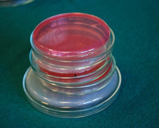 Czy pożywka dla drożdży jest konieczna? Czy pożywka dla drożdży jest konieczna?